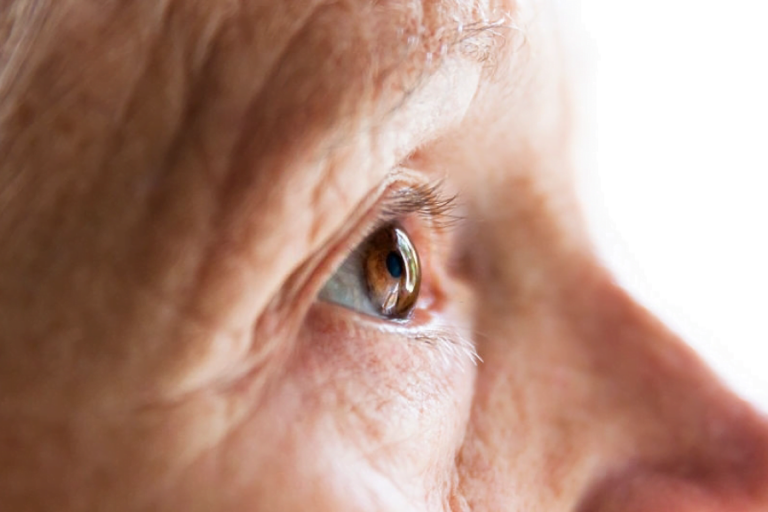 Degeneração Macular Relacionada à Idade